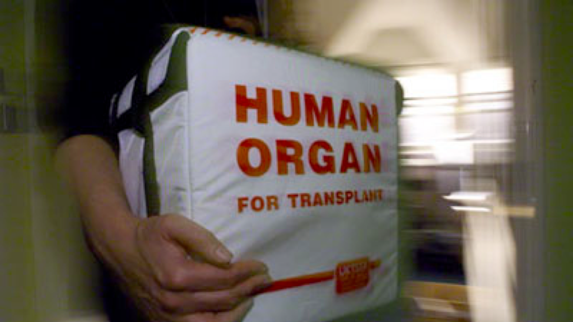 Transplantation rénale croisée