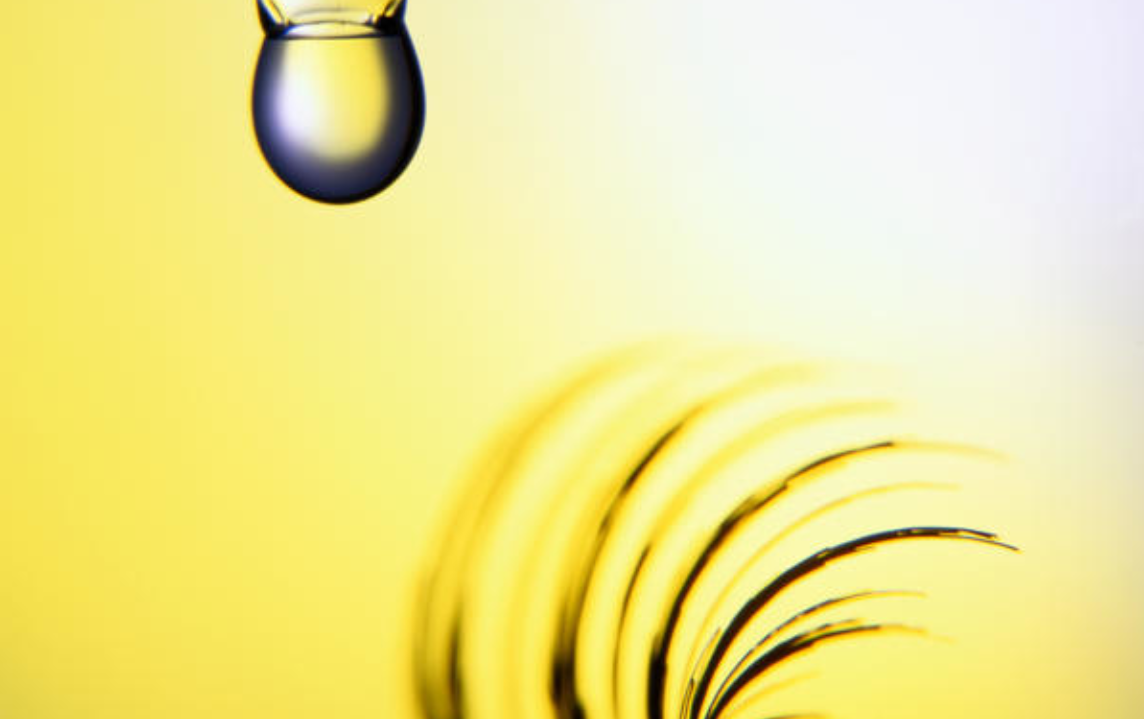 L&rsquo;analyse microscopique du sédiment urinaire
