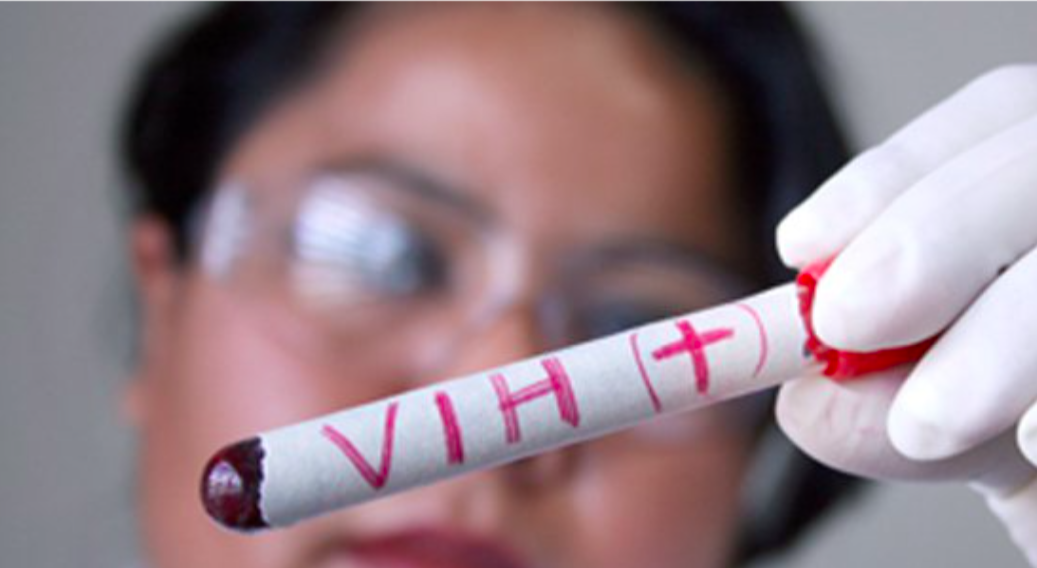 Virus, rein et botanique: le point sur la néphropathie pour le spécialiste du VIH